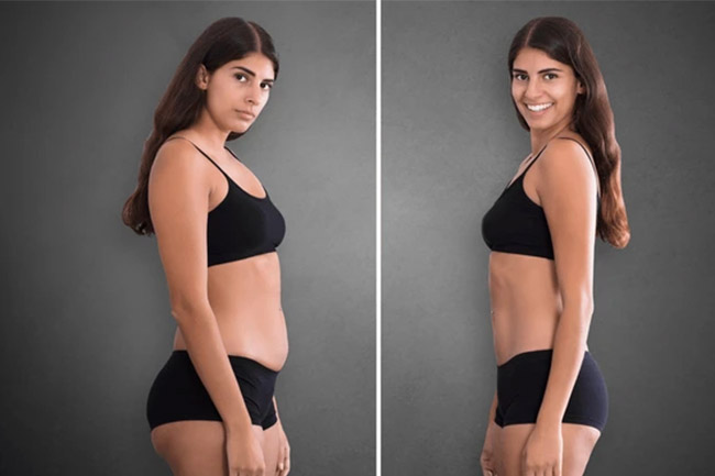 Social Physique Anxiety: Comparison is the Thief of Body Image